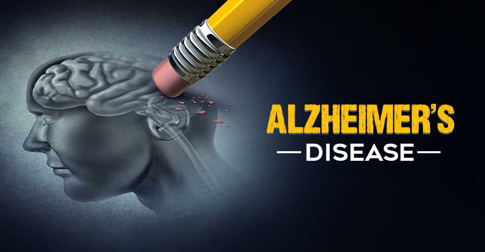 alzheimer's disease