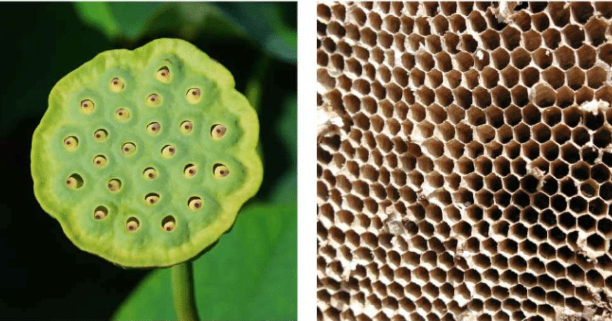 Unraveling Trypophobia: Understanding the Fear of Small Holes and How to Overcome It