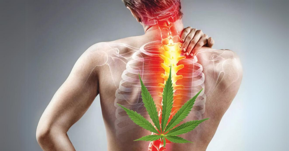 Cannabis Terpenes Offer New Hope for Neuropathic Pain Relief