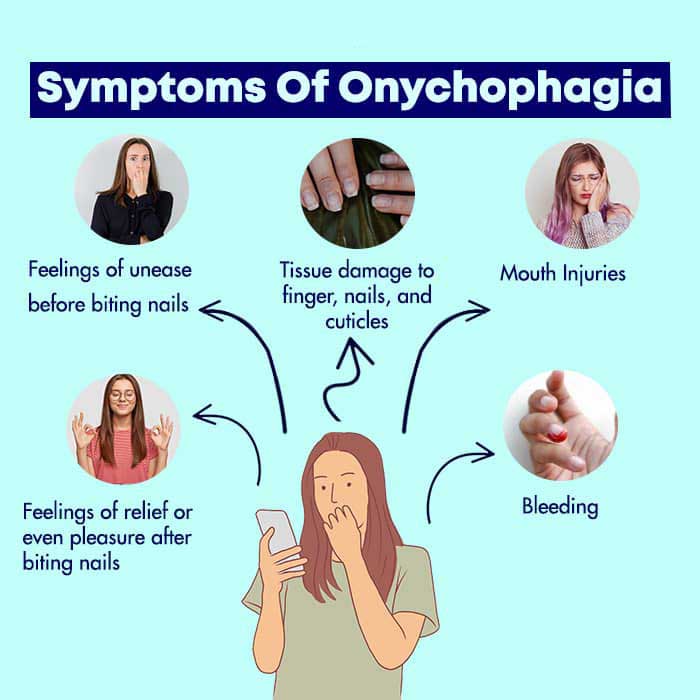 Symptoms Of Onychophagia 1